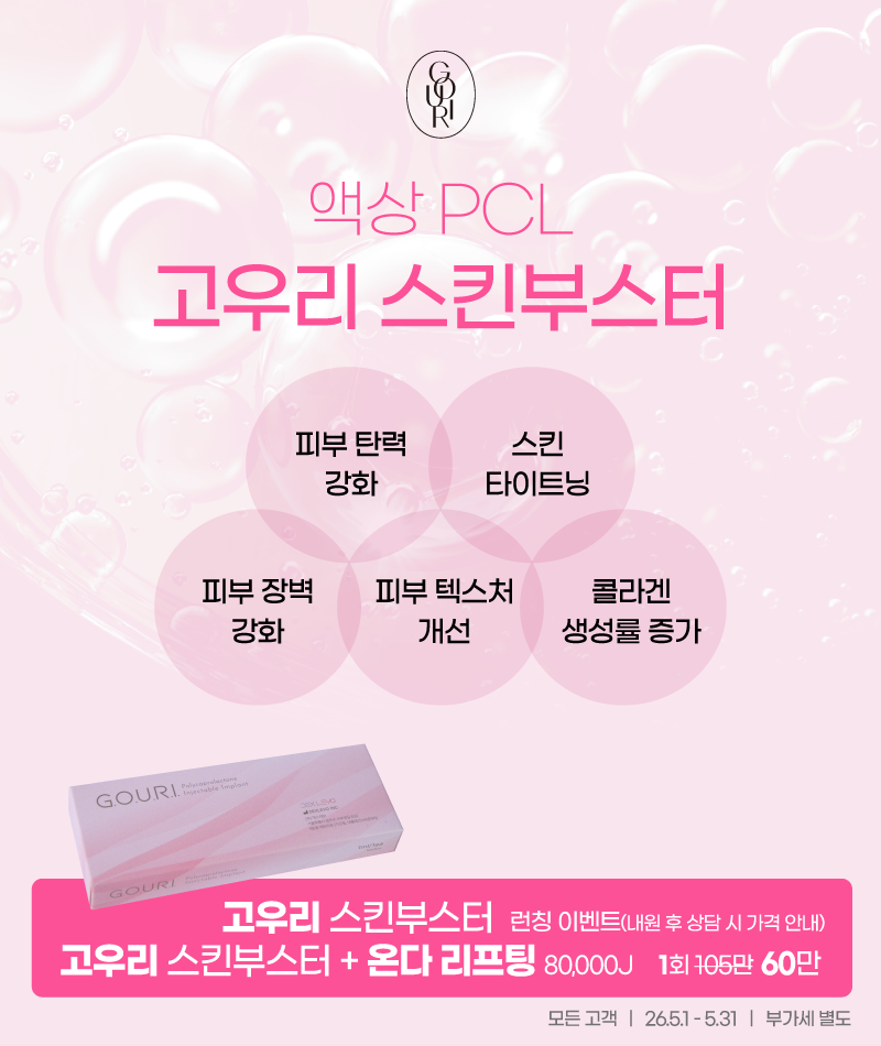 팝업