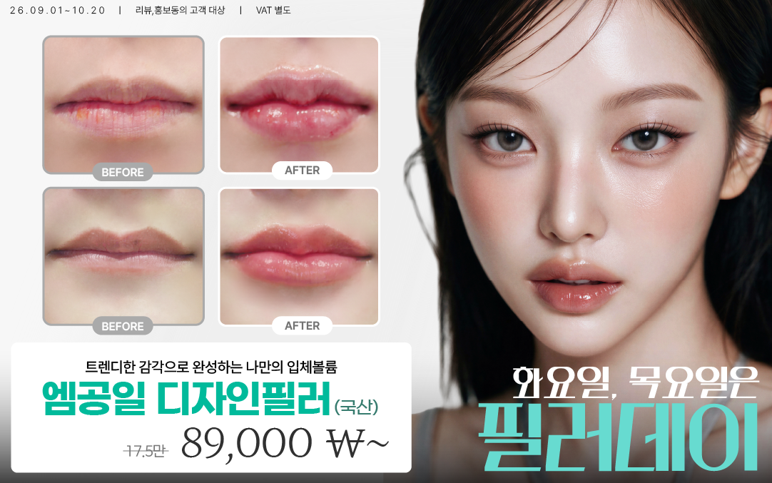 팝업