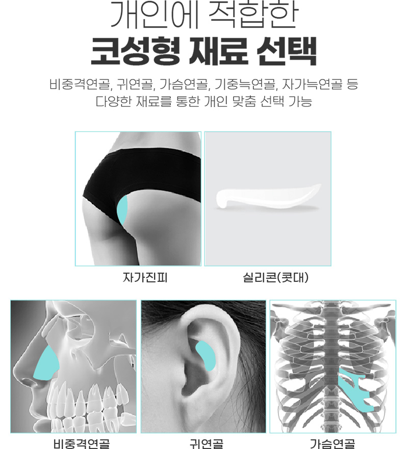 개인에 적합한 코성형 재료 선택