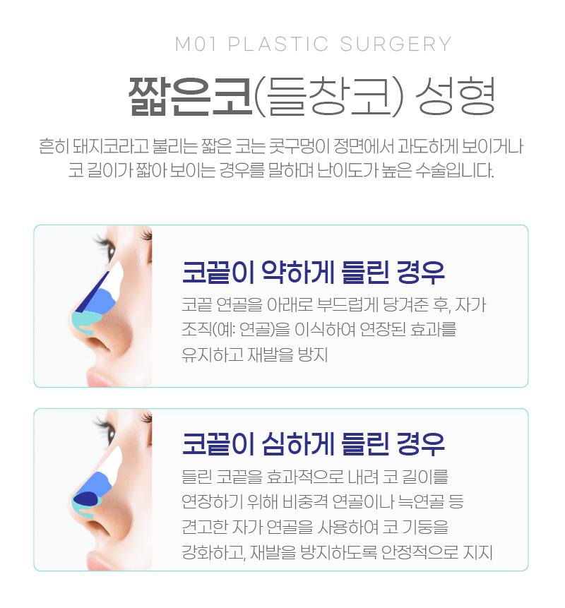 짧은코(들창코) 성형