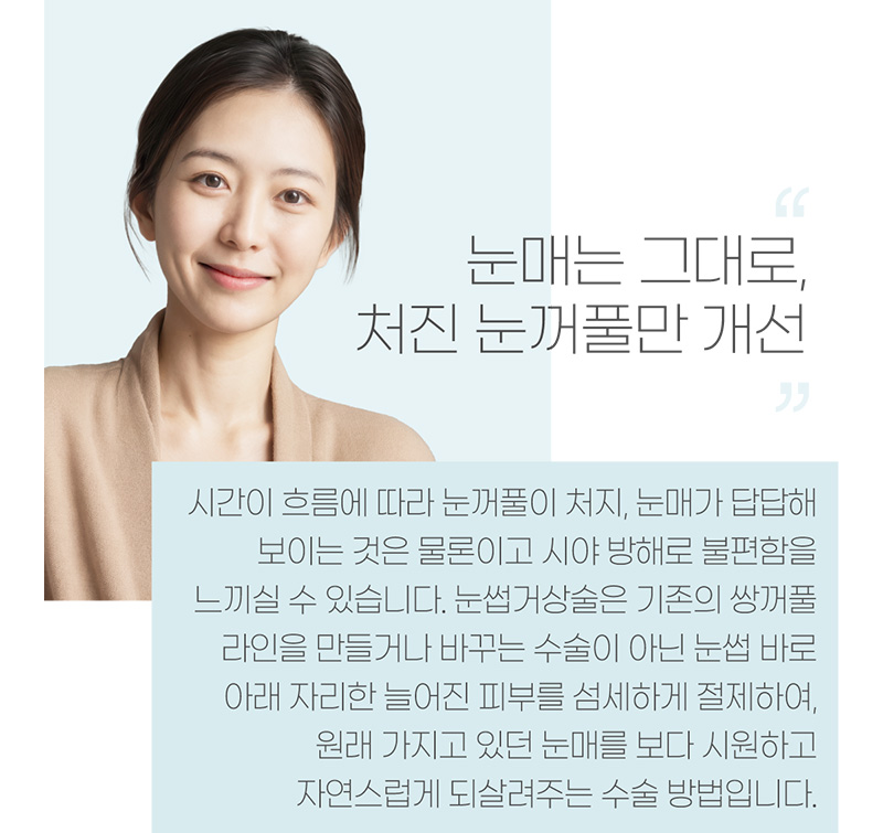 눈매는 그대로, 처진 눈꺼풀만 개선