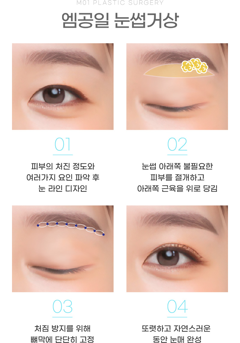 엠공일 눈썹거상