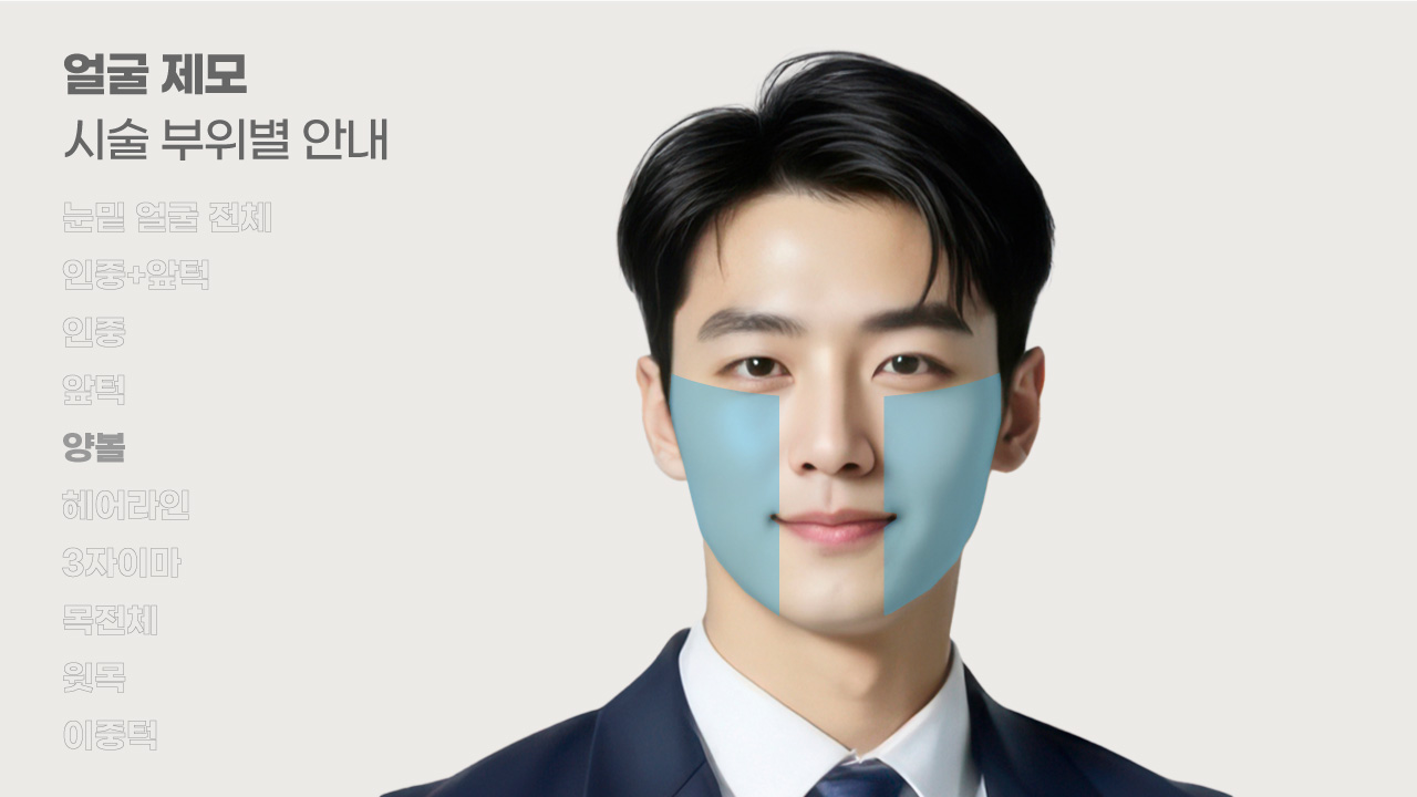 얼굴제모 시술 부위별 안내-5
