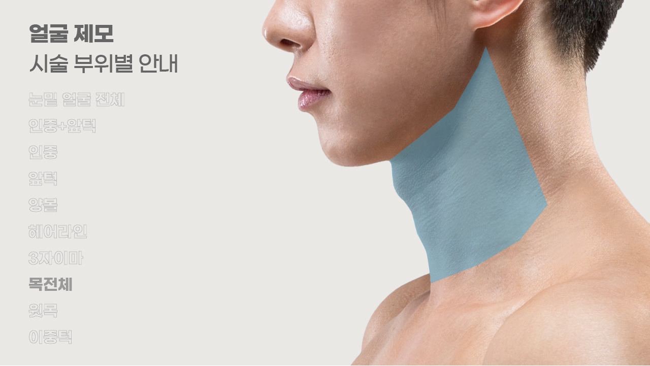 얼굴제모 시술 부위별 안내-8