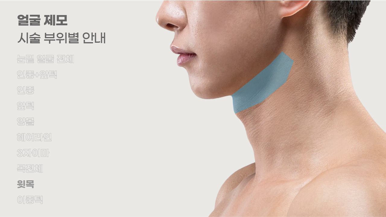 얼굴제모 시술 부위별 안내-9