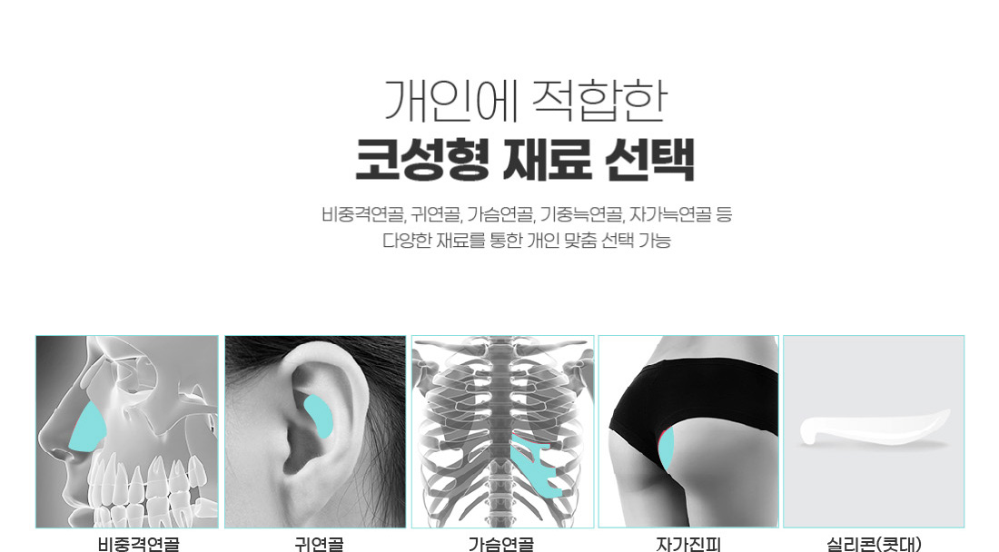 개인에 적합한 코성형 재료 선택