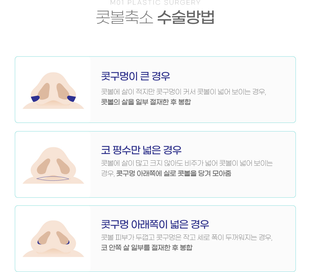 콧볼축소 수술방법