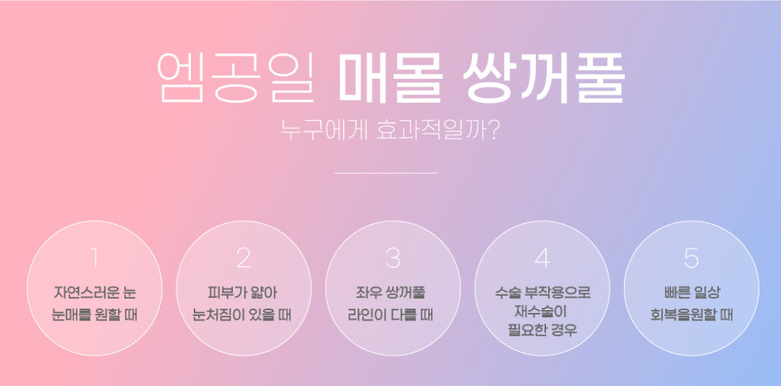 엠공일 매몰 쌍꺼풀 누구에게 효과적일까?