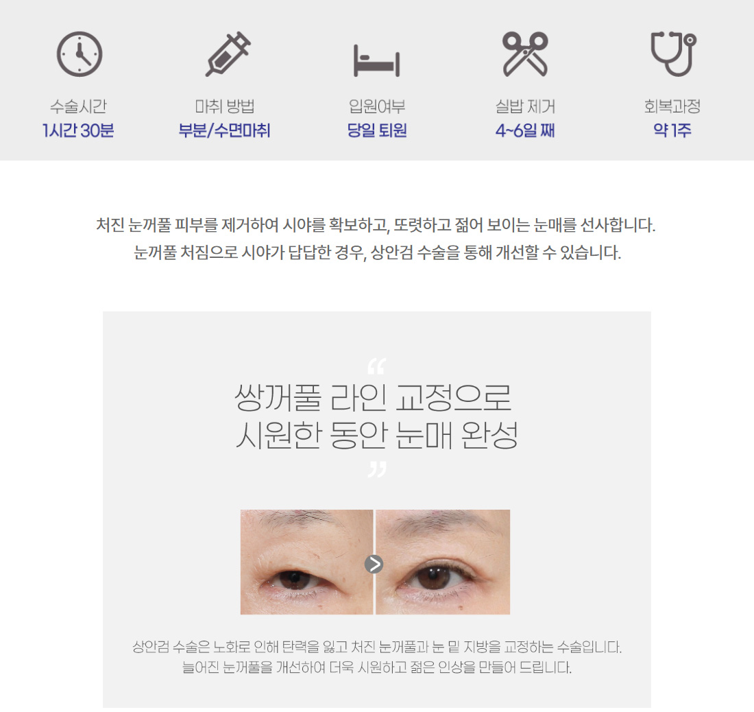 쌍꺼풀 라인 교정으로 시원한 동안 눈매 완성