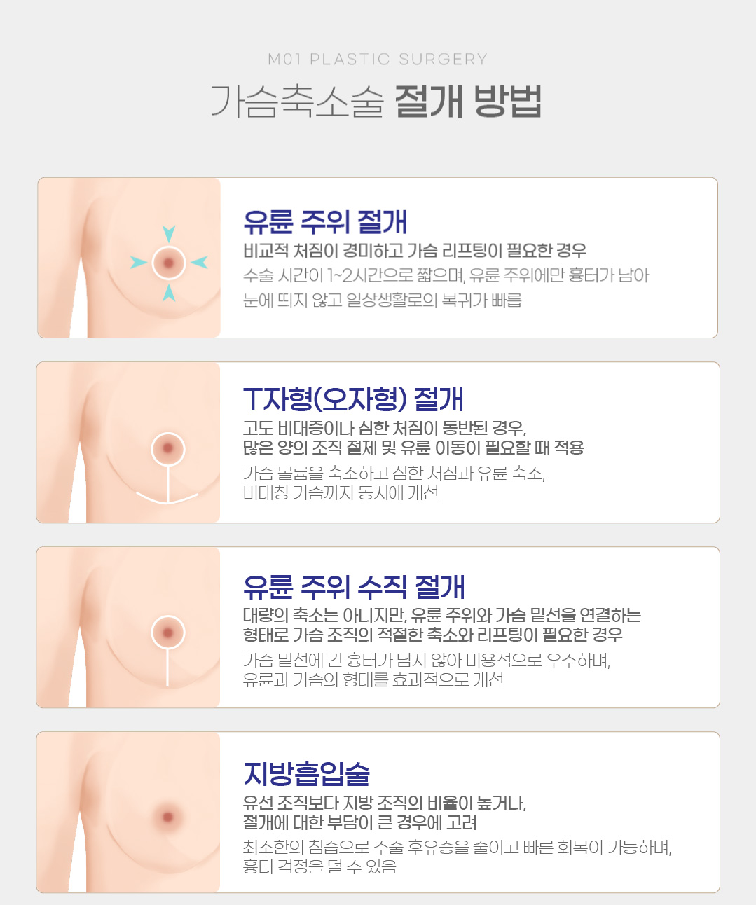가슴축소술 절개 방법